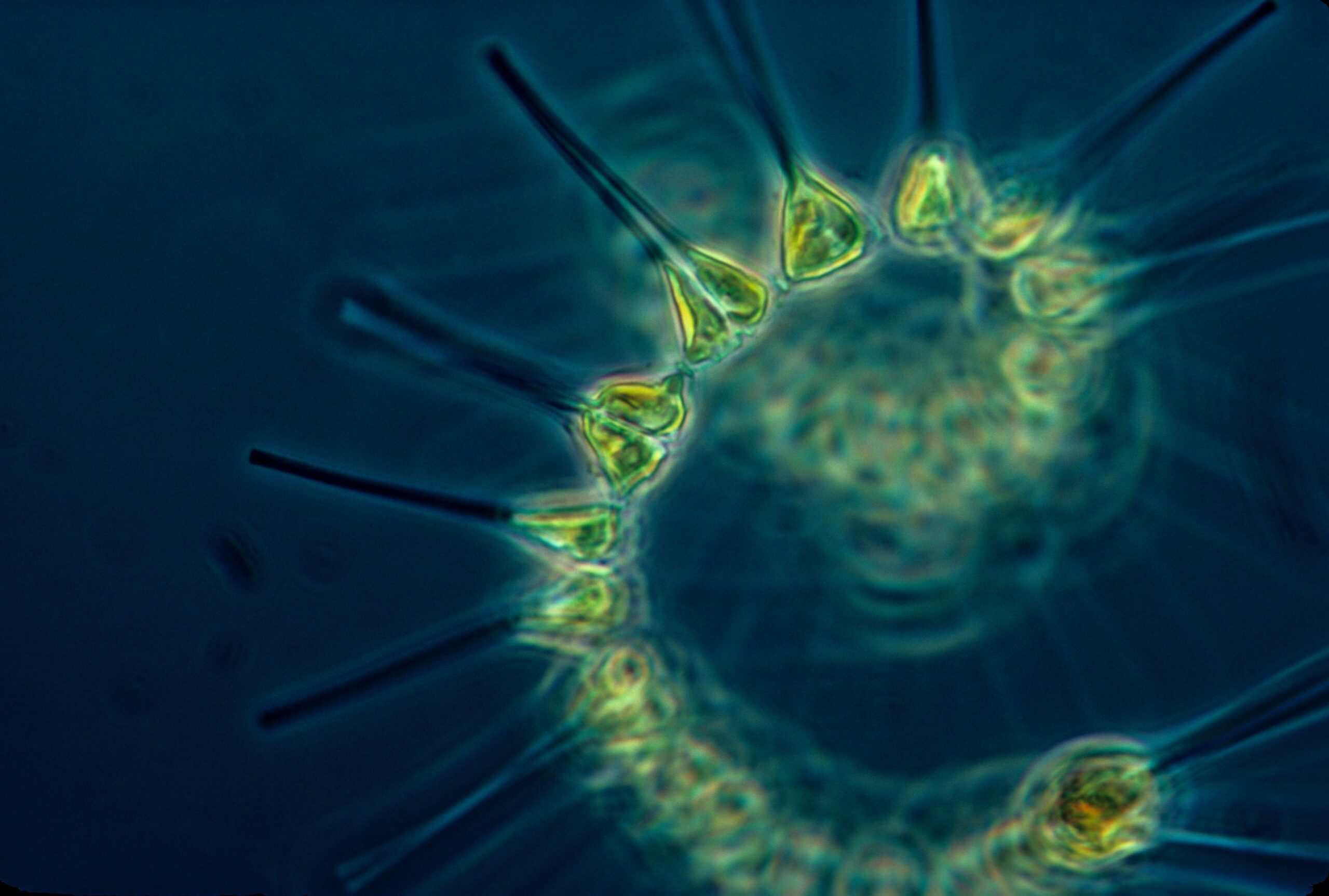 Photo of Phytoplankton in water, bubble like shapes attached to long sticks